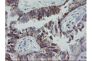 Image no. 1 for anti-Mitochondrial Ribosomal Protein S27 (MRPS27) (AA 151-414) antibody (ABIN1490963)