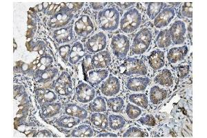 IHC analysis of Clathrin heavy chain/CLTC using anti-Clathrin heavy chain/CLTC antibody (ABIN7602704). (Clathrin Heavy Chain (CLTC) (AA 967-1668) anticorps)