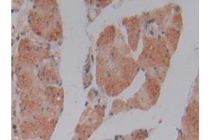 Detection of GSTm4 in Human Stomach Tissue using Polyclonal Antibody to Glutathione S Transferase Mu 4 (GSTm4)