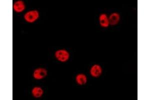 ABIN6277201 staining HepG2 by IF/ICC. (Histone 3 anticorps  (H3K36me))