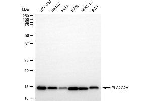 Western blotting analysis using PLA2G2A antibody (ABIN7799821).