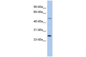 WB Suggested Anti-CTRB1 Antibody Titration:  0. (CTRB1 anticorps  (N-Term))