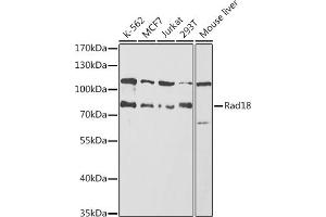 Western blot analysis of extracts of various cell lines, using Rad18 antibody (ABIN6128609, ABIN6146628, ABIN6146630 and ABIN6217430) at 1:1000 dilution. (RAD18 anticorps  (AA 216-495))