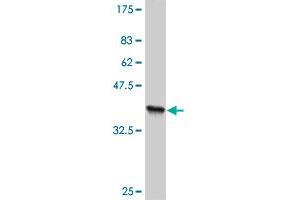 Western Blot detection against Immunogen (36. (TLN1 anticorps  (AA 1052-1149))