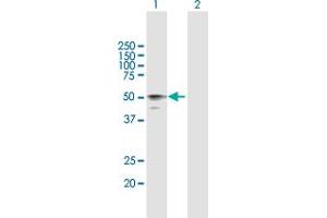 Western Blot analysis of HYAL3 expression in transfected 293T cell line by HYAL3 MaxPab polyclonal antibody. (HYAL3 anticorps  (AA 1-417))