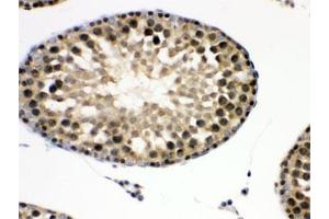 IHC testing of FFPE rat testis with EIF3A antibody. (EIF6 anticorps  (AA 66-210))