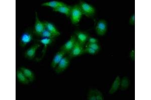 Immunofluorescence staining of HepG2 cells with ABIN7160116 at 1:333, counter-stained with DAPI.