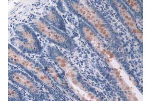 Figure. (OAS1 anticorps  (AA 139-358))