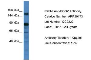 WB Suggested Anti-POGZ Antibody   Titration: 1. (POGZ anticorps  (C-Term))