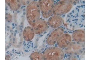 Detection of CTSL in Rat Kidney Tissue using Polyclonal Antibody to Cathepsin L (CTSL)