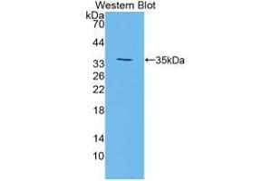 Western blot analysis of the recombinant protein. (TGM3 anticorps  (AA 468-693))