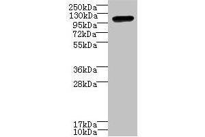 Western blot All lanes: STOX1 antibody at 8 μg/mL + HepG2 whole cell lysate Secondary Goat polyclonal to rabbit IgG at 1/10000 dilution Predicted band size: 111, 26, 20 kDa Observed band size: 111 kDa