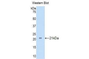 Western Blotting (WB) image for anti-Interleukin 17 Receptor A (IL17RA) (AA 377-534) antibody (ABIN3206298) (IL17RA anticorps  (AA 377-534))