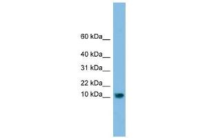 C13orf30 antibody used at 1 ug/ml to detect target protein. (C13orf30 anticorps  (N-Term))