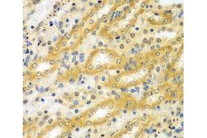 Immunohistochemistry of paraffin-embedded Mouse kidney using ADCK3 Polyclonal Antibody at dilution of 1:100 (40x lens). (COQ8A anticorps)
