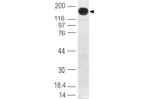 Image no. 1 for anti-DNA (Cytosine-5)-Methyltransferase 1 (DNMT1) (AA 128-429) antibody (ABIN5027162) (DNMT1 anticorps  (AA 128-429))