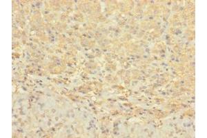 Immunohistochemistry of paraffin-embedded human adrenal gland tissue using ABIN7148072 at dilution of 1:100 (CCDC113 anticorps  (AA 1-200))