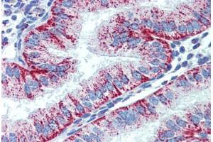 Human Uterus (formalin-fixed, paraffin-embedded) stained with HSPD1 antibody ABIN462364 followed by biotinylated anti-mouse IgG secondary antibody ABIN481714, alkaline phosphatase-streptavidin and chromogen.