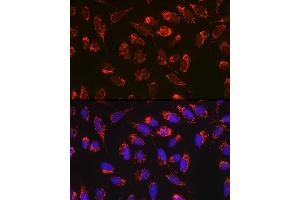 Immunofluorescence analysis of U-2 OS cells using Bax Rabbit mAb  at dilution of 1:100 (40x lens). (BAX anticorps)