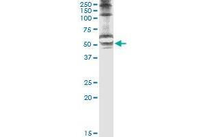 Immunoprecipitation of STK25 transfected lysate using anti-STK25 monoclonal antibody and Protein A Magnetic Bead , and immunoblotted with STK25 monoclonal antibody.