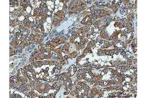 IHC analysis of SNX1 using anti-SNX1 antibody (ABIN7602548).