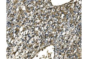 IHC analysis of CX3CR1 using anti-CX3CR1 antibody (ABIN7599293). (CX3CR1 anticorps  (AA 1-345))