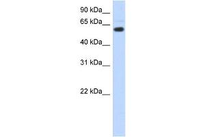 WB Suggested Anti-CDYL Antibody Titration:  0. (CDYL anticorps  (N-Term))