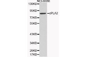 Western Blotting (WB) image for anti-Phospholipase A2, Group IVA (Cytosolic, Calcium-Dependent) (PLA2G4A) (AA 1-180) antibody (ABIN3020971) (PLA2G4A anticorps  (AA 1-180))