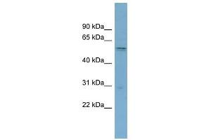 SLC7A11 antibody used at 1 ug/ml to detect target protein. (SLC7A11 anticorps)