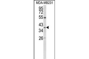 Western blot analysis of ARG1 Antibody (C-term) (ABIN652925 and ABIN2842593) in MDA-M cell line lysates (35 μg/lane). (Liver Arginase anticorps  (C-Term))