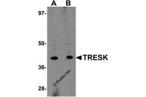 Western blot analysis of TRESK in rat brain tissue lysate with this product at (A) 1 and (B) 2 μg/ml. (KCNK18 anticorps  (Center))