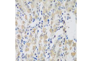 Immunohistochemistry of paraffin-embedded human stomach using VPS4A antibody (ABIN5974267) at dilution of 1/100 (40x lens). (VPS4A anticorps)