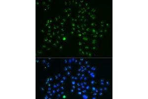Immunofluorescence analysis of MCF7 cells using GNL3 Polyclonal Antibody