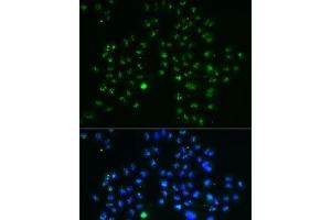 Immunofluorescence analysis of MCF7 cells using GNL3 Polyclonal Antibody (Nucleostemin anticorps)