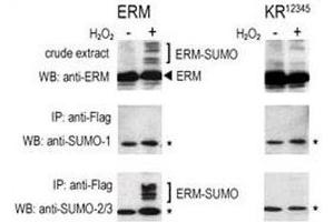 COS-7 cells were transfected for 24 hrs with a plasmid expressing FLAG-ERM (left panels) or FLAG-ERM KR12345 (right panels). (SUMO1 anticorps  (AA 55-86))