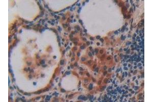 Detection of VAV3 in Human Thyroid Tissue using Polyclonal Antibody to Vav 3 Oncogene (VAV3)