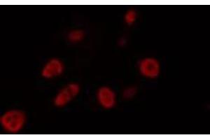 ABIN6274462 staining LOVO cells by IF/ICC. (FOXJ1 anticorps  (Internal Region))