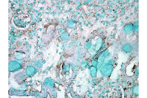 Immunohistochemistry analysis using Rabbit Anti-HSP70 Polyclonal Antibody . (HSP70 anticorps  (PE))