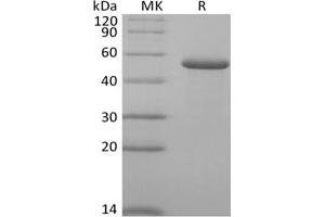 Western Blotting (WB) image for Reticulocalbin 2, EF-Hand Calcium Binding Domain (RCN2) protein (His tag) (ABIN7319916)