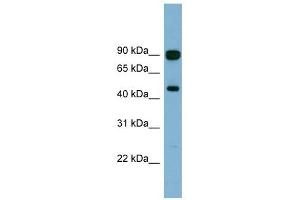 AGK antibody used at 1 ug/ml to detect target protein.