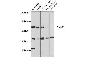 Western blot analysis of extracts of various cell lines, using SLC4 antibody (7391) at 1:1000 dilution. (Band 3/AE1 anticorps  (AA 1-353))