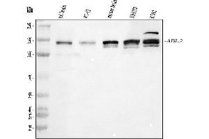 Western blot analysis of ABL2 using anti-ABL2 antibody (ABIN4886412). (ABL2 anticorps  (AA 1065-1182))