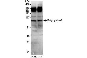 Western Blotting (WB) image for anti-Polycystic Kidney Disease 2 (Autosomal Dominant) (PKD2) (AA 918-968) antibody (ABIN7451972) (PKD2 anticorps  (AA 918-968))