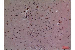 Immunohistochemistry (IHC) analysis of paraffin-embedded Mouse Brain, antibody was diluted at 1:100.