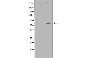 Western blot analysis of Hela whole cell lysates, using PPP3CA  Antibody. (PPP3CA anticorps  (N-Term))