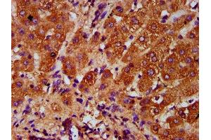 IHC image of ABIN7143840 diluted at 1:400 and staining in paraffin-embedded human liver tissue performed on a Leica BondTM system.