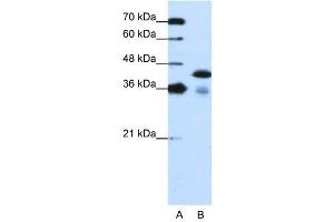 WB Suggested Anti-TARDBP  Antibody Titration: 1. (TARDBP anticorps  (C-Term))
