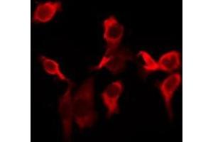 ABIN6277050 staining Hela by IF/ICC.