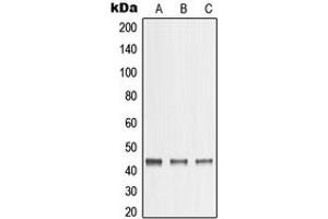 Western blot analysis of MMP23 expression in A431 (A), A375 (B), HeLa (C) whole cell lysates. (Matrix Metallopeptidase 23 (MMP23) (C-Term) anticorps)
