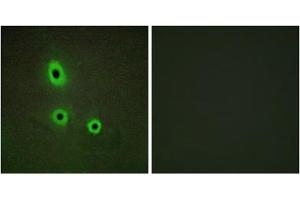 Immunofluorescence analysis of A549 cells, using EFNA5 antibody. (Ephrin A5 anticorps  (Internal Region))